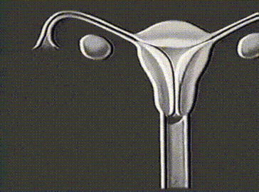 fehér menstruáció