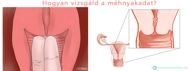 hogyan vizsgáld a mehnyakat