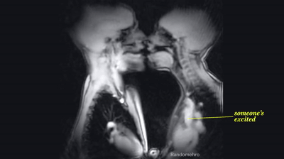 kiss_in_MRI